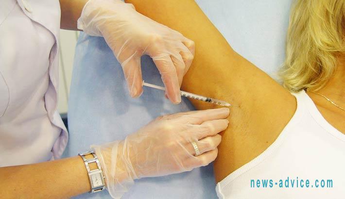 ботокс проти поту