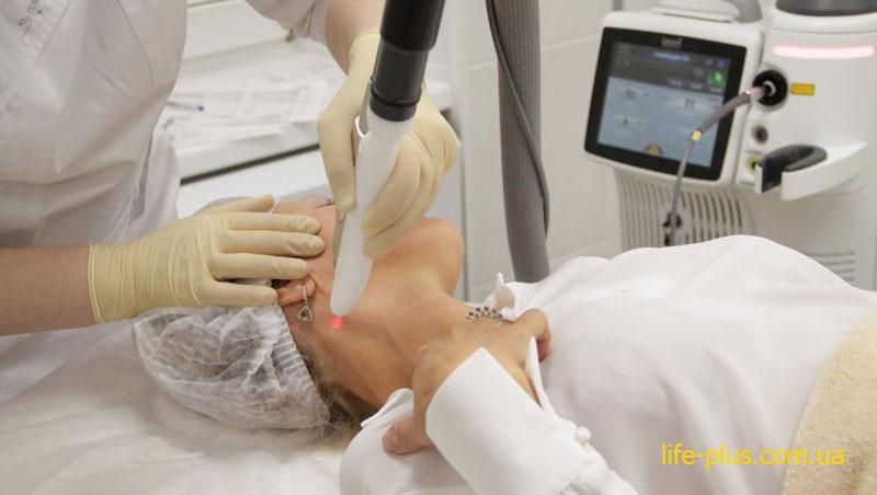 photon laser rejuvenation