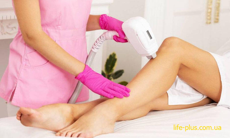 laser hair removal