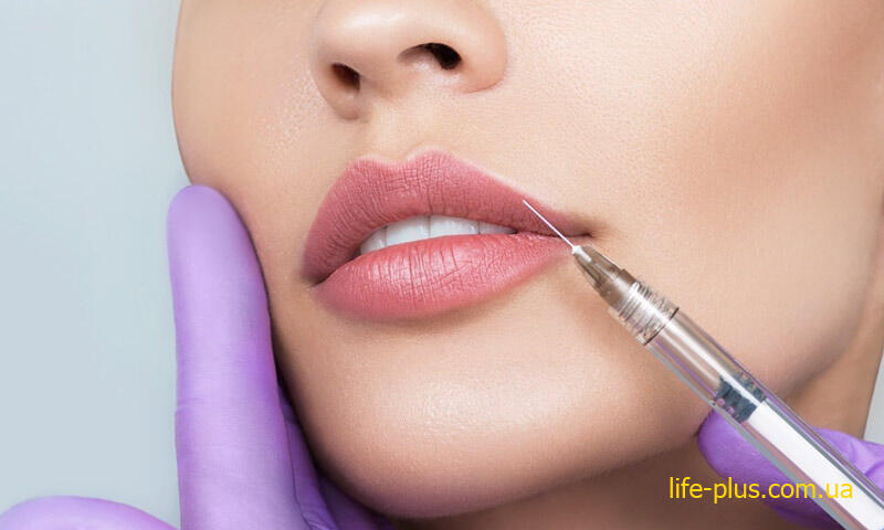 contouring lip augmentation