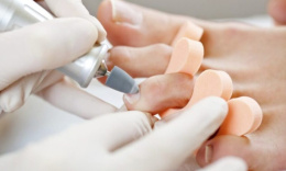 Hardware pedicure in Obolon Cosmetology beauty procedures Hardware pedicure in Obolon